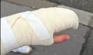 На Теремках поліція прокладає шлях для теплотраси зі знесенням 100-річних дубів