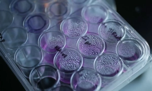 У центрі нашої голови відкрили невідомий досі орган. Як це допоможе в лікуванні людей із раком?