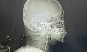 Заворушення у в'язниці у Венесуелі забрали життя кількох десятків людей