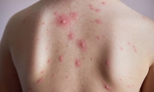 Вживання кави може зменшити ризик старіння, але в міру