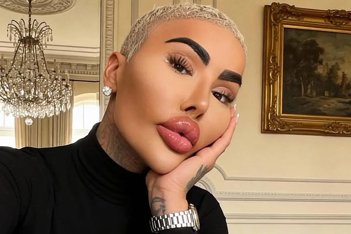 Man in Britain dies after cosmetic procedures attempting to look like Kim Kardashian