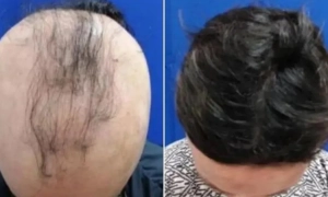 У пошуках нескінченного задоволення: що таке пролонгатори та якими вони бувають