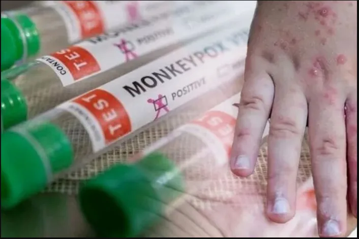 У Європі мутує мавпяча віспа, штам стійкий до ліків