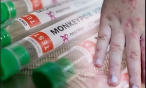 На українців очікують п’ять різних штамів грипу: перелік вірусів