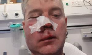 В Ирландии футболисты напали на арбитра и сломали ему челюсть