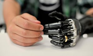 В Швеции впервые подключили протез руки, который дает тактильные ощущения