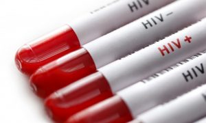 Еще один ВИЧ-положительный человек вылечился от вируса иммунодефицита