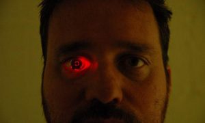 Фото: канадец встроил камеру в глаз