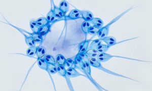 Ученые обнаружили паразита, которому для существования не нужен кислород