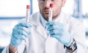 Число инфицированных коронавирусом в Украине, намного выше подтверждённых случаев