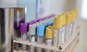 В США началось масштабное тестирование вакцины от COVID-19 