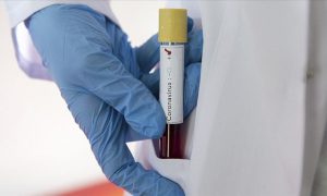   COVID-19 в Украине: новых случае немного меньше, но всё равно более 2 тысяч 