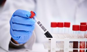 COVID-19 в Украине: за день – новый антирекорд 