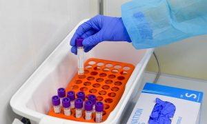 В МОЗ сообщили, как планируют увеличивать количество ПЦР-тестов 