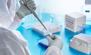 COVID-19 в Украине: наконец-то меньше 7 тыс. случаев за день 