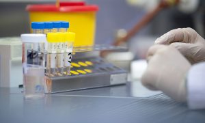 Государство будет оплачивать тесты на COVID-19 в частных лабораториях 