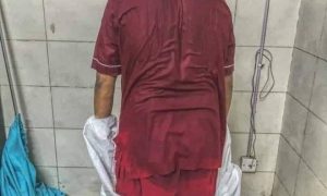 «На полу спали две медсестрички»: в сети рассказали об ужасных условиях «коронавирусной» больницы в Житомире