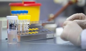 Украина начала использовать тесты на COVID-19 собственного производства