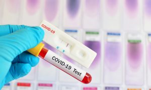 Минздрав увеличит количество бесплатных тестов на СOVID-19