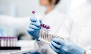 В Минздраве объяснили, почему уменьшилось количество ПЦР-тестов на COVID-19