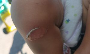 В Одессе ребенок получил ожоги рук и ног из-за известной скульптуры