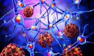 Никаких чудес, только наука. Найден способ вылечить рак без химиотерапии и облучения