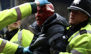 В Англії вболівальнику розбили голову під час масових заворушень на стадіоні — фото