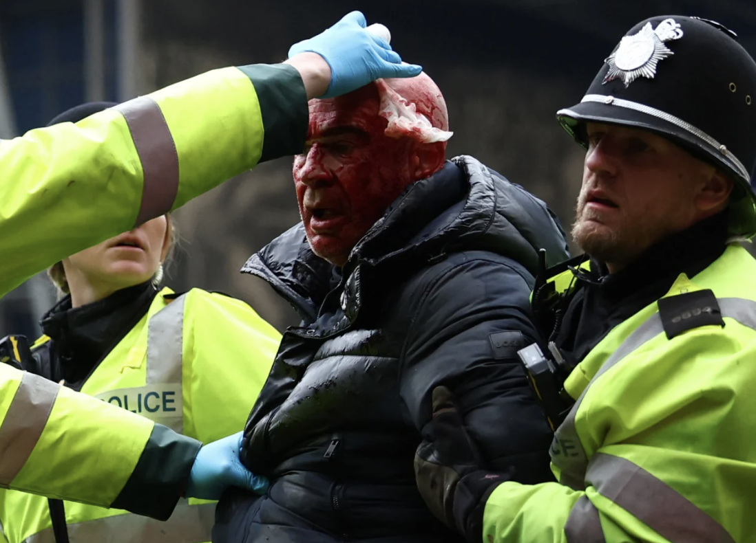 В Англії вболівальнику розбили голову під час масових заворушень на стадіоні — фото